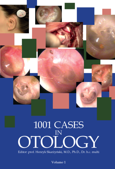 1001 cases in otology